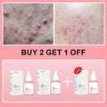 PDRN Collagen Peptide Facial Serum