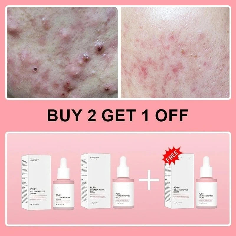 Salmon PDRN Collagen Peptide Facial Serum For Dull Skin - Boosts