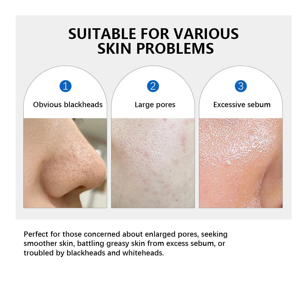 4.5% AHA Lactic Acid & 0.45% BHA 0-Pore Toner Pad Salicylic Acid