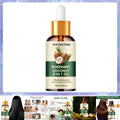 Rosemary Oil Hair Essential Coconut Oil Improve Hair Loss And Nourishes