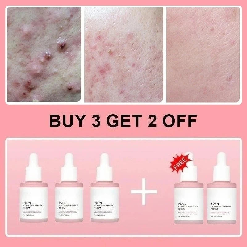 Salmon PDRN Collagen Peptide Facial Serum For Dull Skin - Boosts